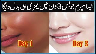 Skin Whitening Serum | How To Get Glowing Skin | Skin Care Tips In Urdu | Bright Skin Tips