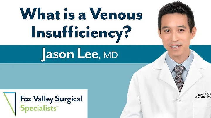 Venous Insufficiency with Dr. Jason Le