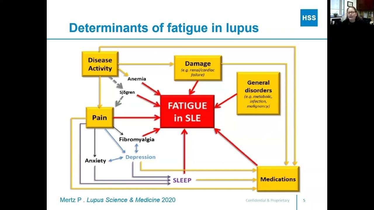 Lupus and Fatigue What You Should Know (HSS) YouTube