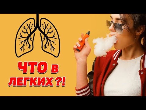 Как электронные сигареты Elf Bar влияют на твои легкие в сравнении с классическими сигаретами ?!