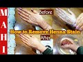 How to remove henna mehndi stain from skin  simple and safe ways to remove mehndi stain