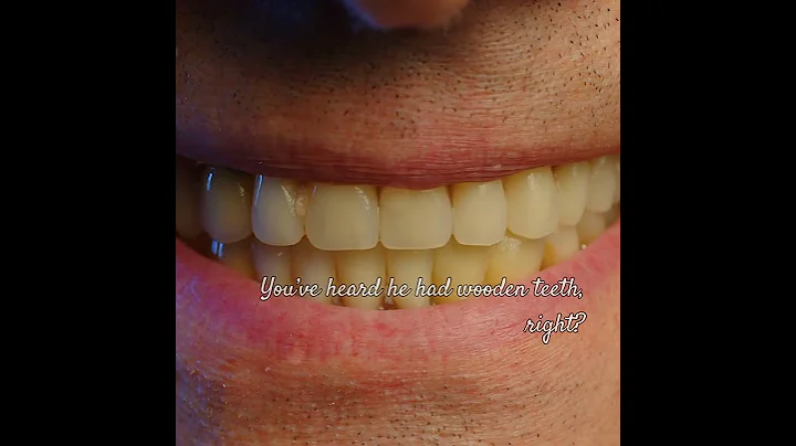 five bizarre historical facts #WeirdHistory, #FunFacts, #HistoryFacts, #DidYouKnow,  #youtubeShorts