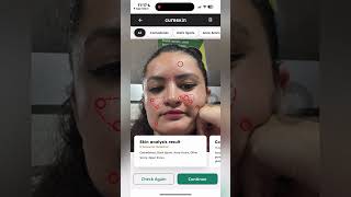 If you also have the same problem here the solution: cure app #cure #cureskinapp #cureskin