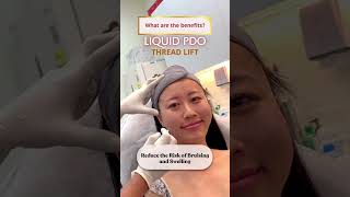 What are the benefits of Liquid PDO Thread Lift?