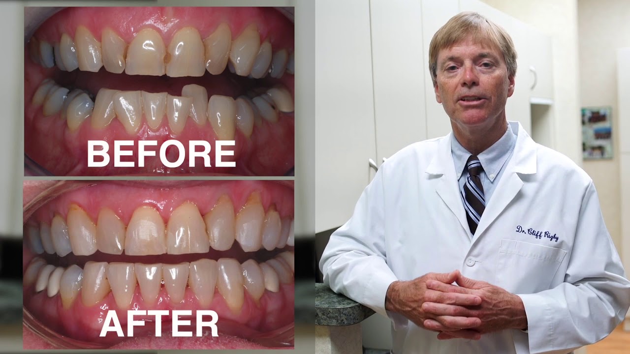 Why are so many Adults getting Orthodontics?" j. Clifford Rigby D.M.D