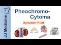 Pheochromocytoma | Symptoms and Treatment