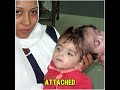 6 Kids From Around The World Born With Extremely Rare Conditions 😱🧬 #RareConditions #MedicalWonders