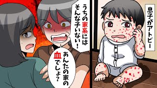 【LINE】アトピーの息子を見た義母「うちの家系にはそんな子いない!あんたの家の血でしょ?」→アトピーが治ったら手のひら返ししてきたので…【スカッとする話】