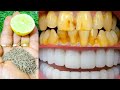 सिर्फ 2 मिनट में पीले दांतो को मोती की तरह चमका देगा यह अद्भुत घरेलू नुस्खा Teeth Whitening Remedy