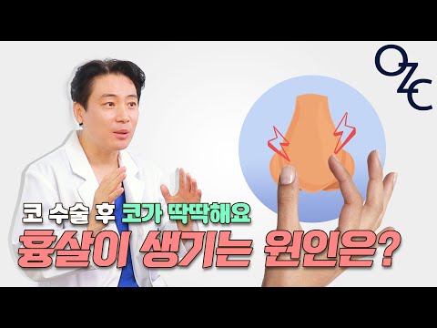 코가 딱딱해요_코성형 후 흉살이 생기는 원인은?[앤플러스]