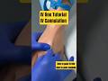 IV line | Iv Cannulation| intravenous Cannulation| IV injection  #nurse #doctor