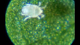 Organism on underside of maple leaf, 100-250×