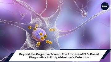 Beyond the Cognitive Screen: The Promise of EEG-Based Diagnostics in Early Alzheimer