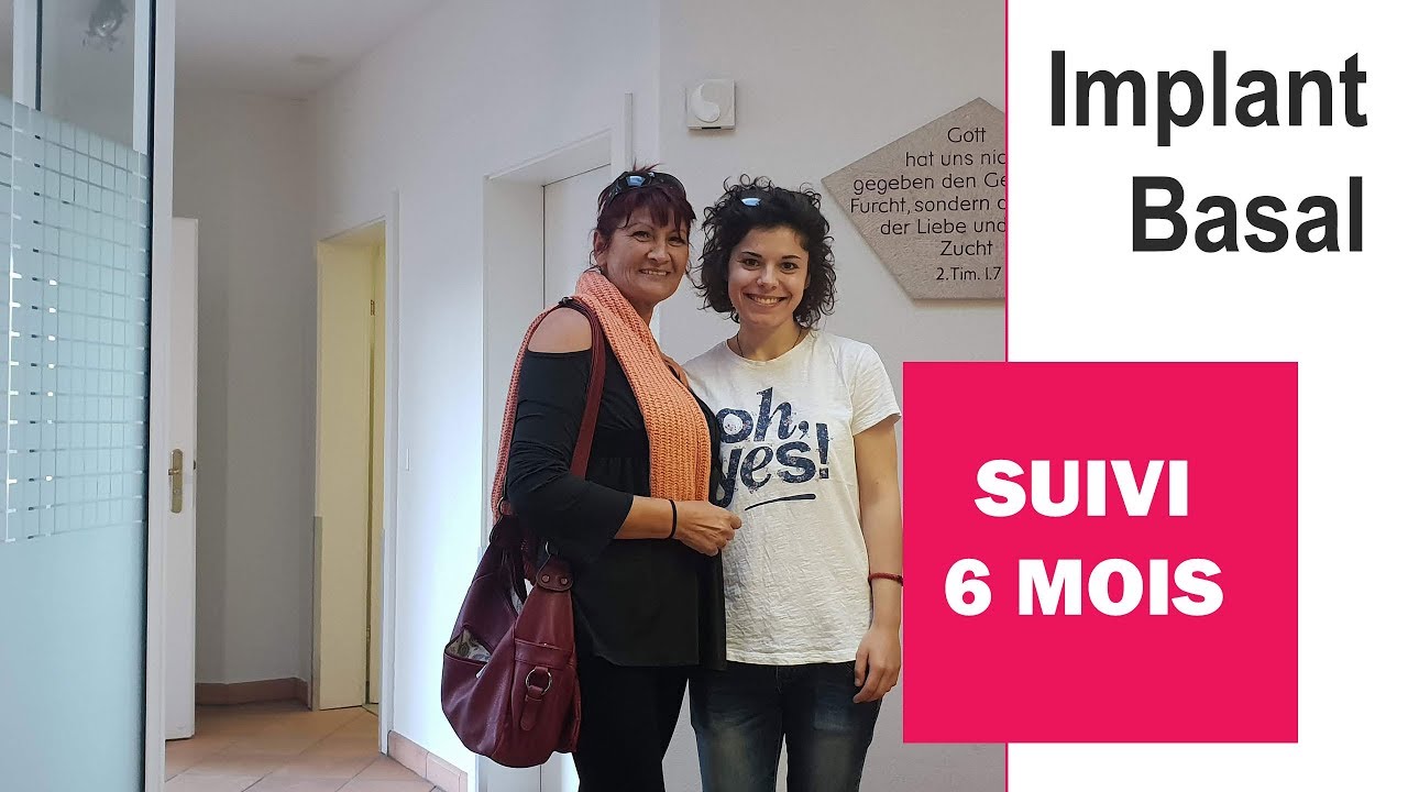 Implants basaux - Avis sur les implants dentaires sans  greffe osseuse