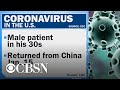 First U.S. case of deadly coronavirus diagnosed in Washington state