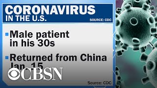 First U.S. case of deadly coronavirus diagnosed in Washington state