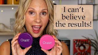 🤩 Oralift 4 Month Review, Before & After Photos |🤩  Best Beauty Products | Skin Obsessed Mary screenshot 2