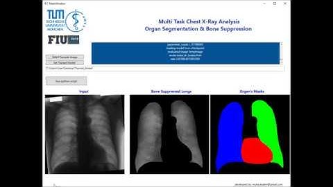 Multi-task lung image analysis