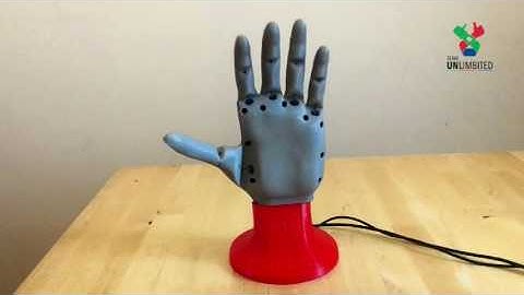 Open Bionics ADA Hand by Team UnLimbited