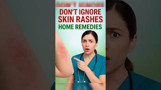 Quick Home Remedies For Skin Rashes