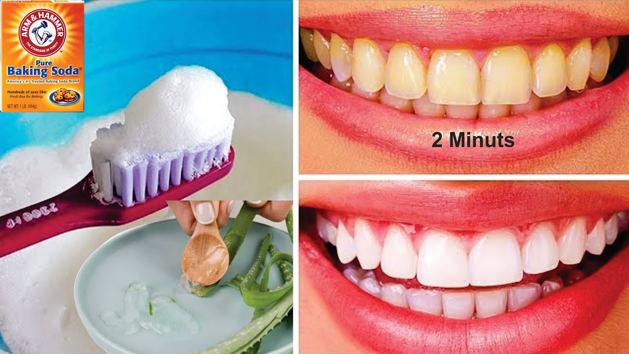 magical-teeth-whitening-works-l-best-way-to-clean-your-teeth-l-remove