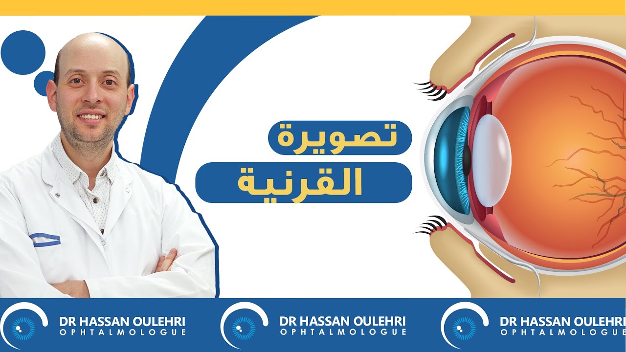 راديو القرنية - الدكتور حسن أولهري -