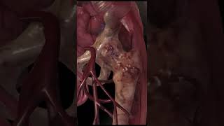 Sniper Elite 4 Testicle Shot Stealth