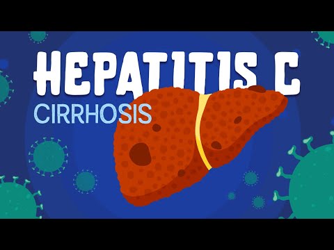 Video: Chronic Hepatitis C - Symptoms, Diagnosis And Treatment