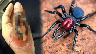 20 Most Poisonous Spider Bites in the World