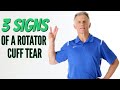 Top 3 Signs Of A Rotator Cuff Tear (Updated)