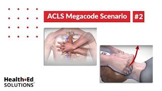 ACLS Megacode Scenario 2: Out of Hospital Cardiac Arrest - CPR and AED