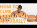 How to cure varicocele naturally ?