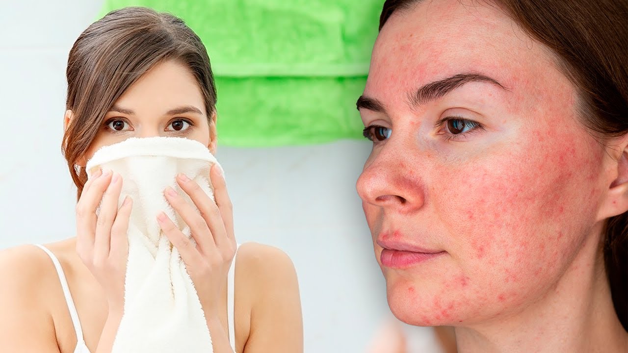 Why You Should Never Dry Your Face With a Hand Towel
