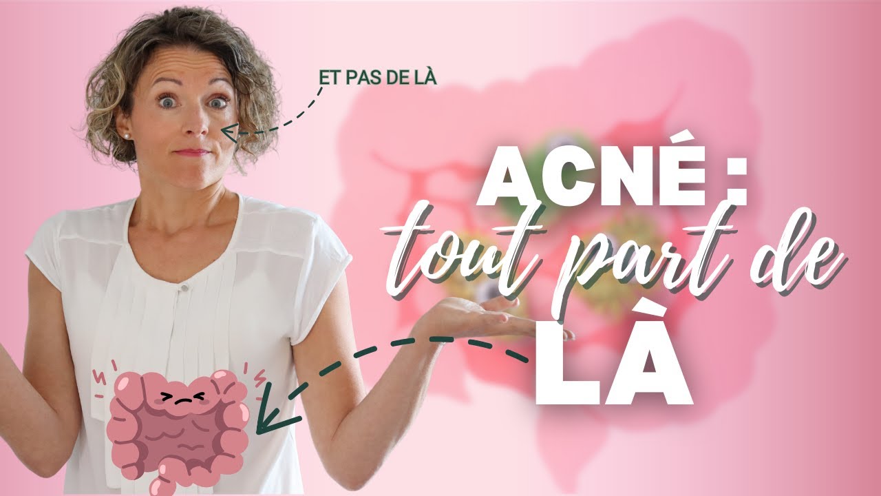 Acné hormonale, inflammatoire, kystique : le rôle ignoré de ton intestin