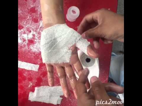 Una mano de yeso / Tutorial 