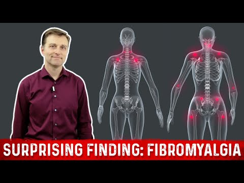 What is Fibromyalgia – Surprising Finding Explained by Dr.Berg