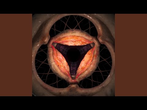 Hyph11E — Knots