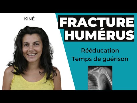 Vidéo: Comment poser une attelle sur une fracture de l'humérus : 8 étapes (avec photos)