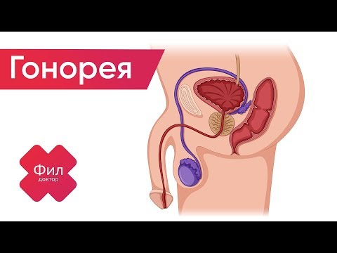 ГОНОРЕЯ как лечить | Как вылечить ГОНОРЕЮ дома | Симптомы | Триппер | Диагностика | Лечение