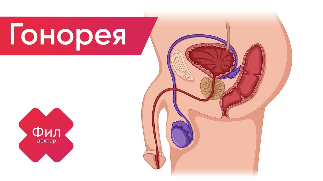 лекарства от гонореи у мужчин в таблетках