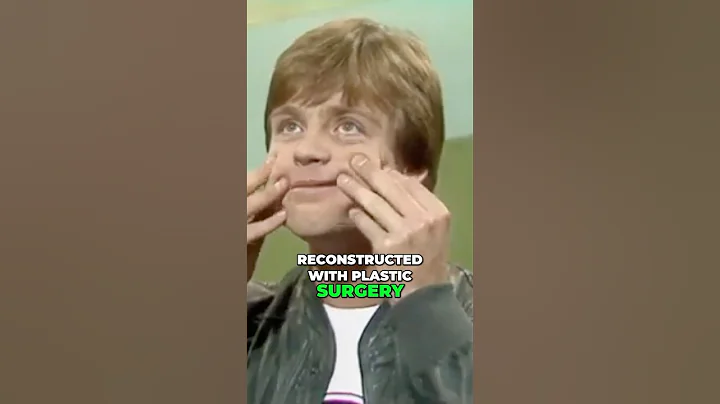 Why Mark Hamill Face Changed Between Episode 4 & 5