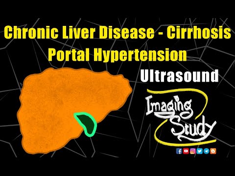 Chronic Liver Disease - Cirrhosis - Portal Hypertension - Portosystemic Collaterals || Imaging Study