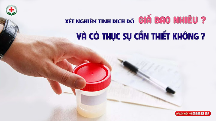 Xét nghiệm tinh dịch đồ chi phí bao nhiêu năm 2024