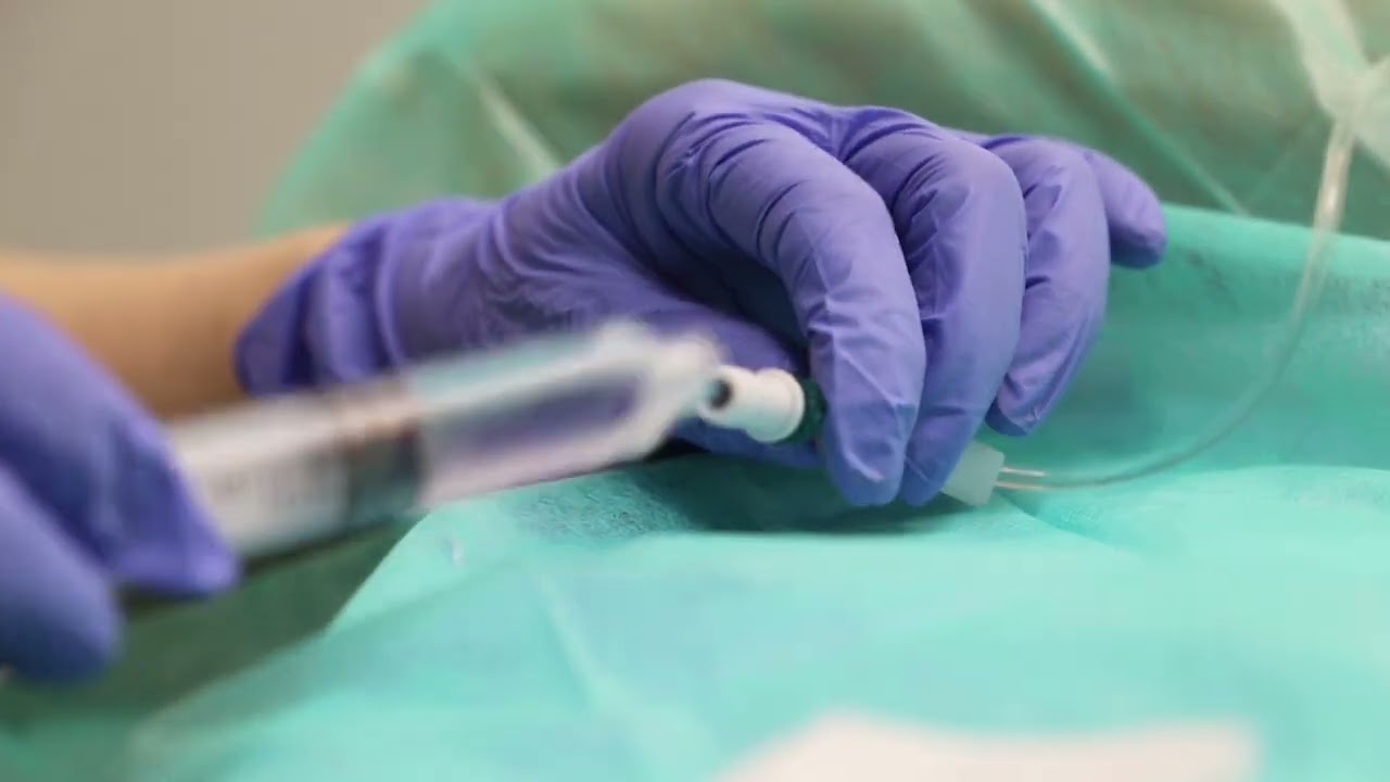 4. RETIRADA AGUJAS HUBER