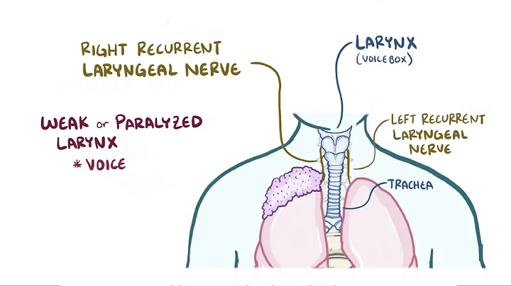 Pancoast tumors   causes, symptoms, diagnosis, tre...