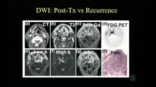 Imaging as a Prognostic Tool – MR Diffusion and Perfusion