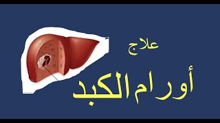 أ.د. احمد سليم فؤاد .. علاج اورام الكبد