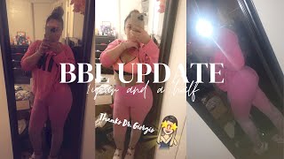 BBL Update/ 1 yr and a half/ Dr. Giorgis