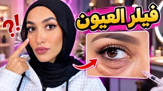 تجربتي مع فيلر العيون | كارثه .. خربتلي شكلي