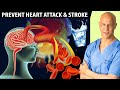 The best times to drink water to prevent heart attack  stroke  dr mandell